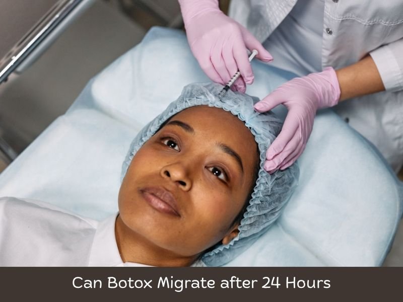 Can Botox Migrate after 24 Hours